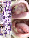 銀歯vs虫歯を発見 ダブル口腔淫診ショー－グリップAVのDVD画像