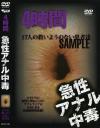 急性アナル中毒－-のDVD画像
