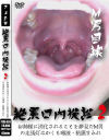 絶景口内検診 No2－-のDVD画像